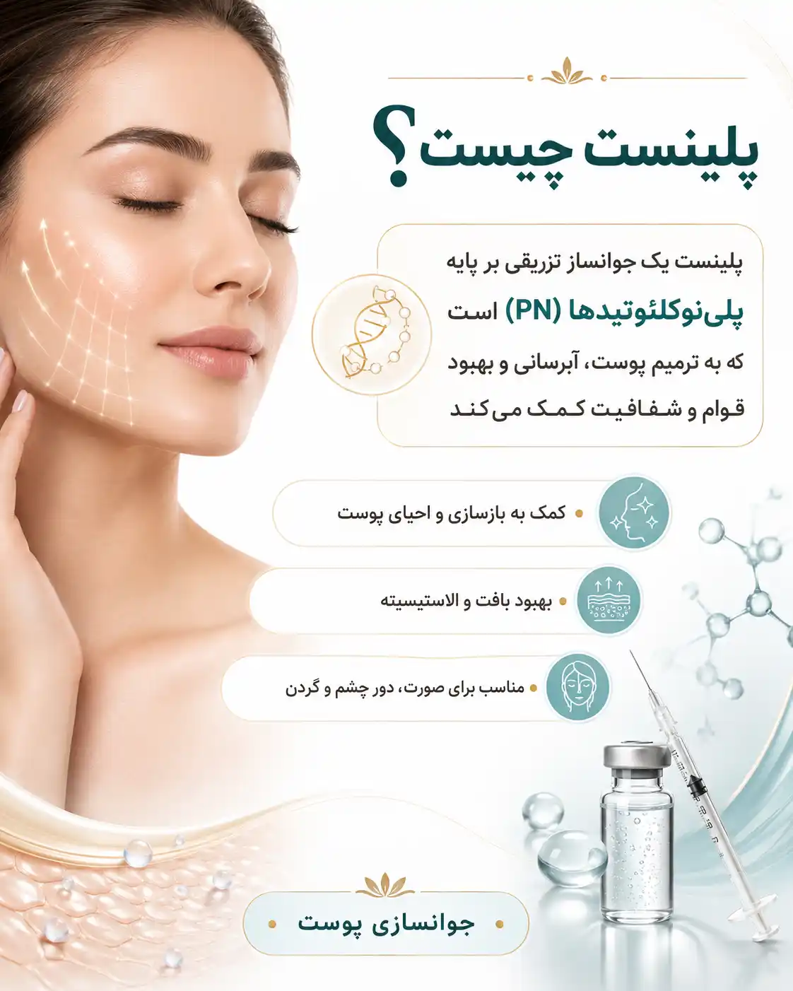 پلینست چیست؟