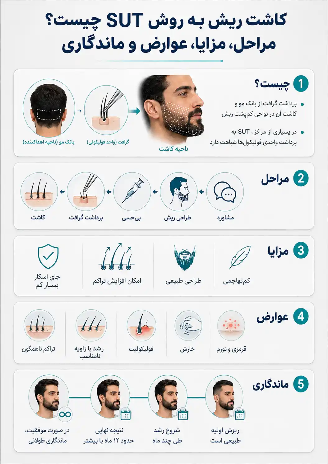 کاشت ریش به روش SUT چیست؟ مراحل، مزایا، عوارض و ماندگاری