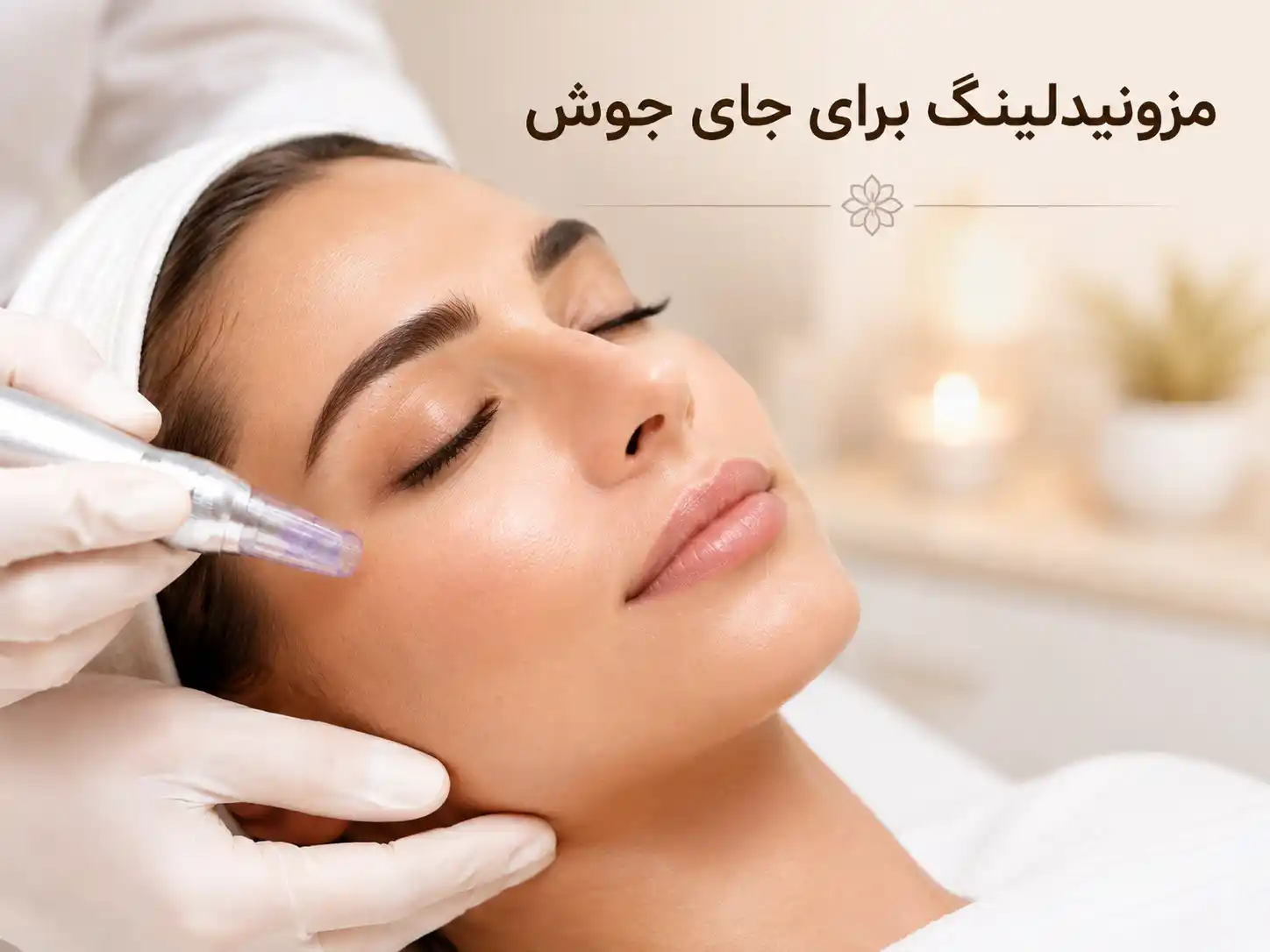 مزونیدلینگ برای جای جوش