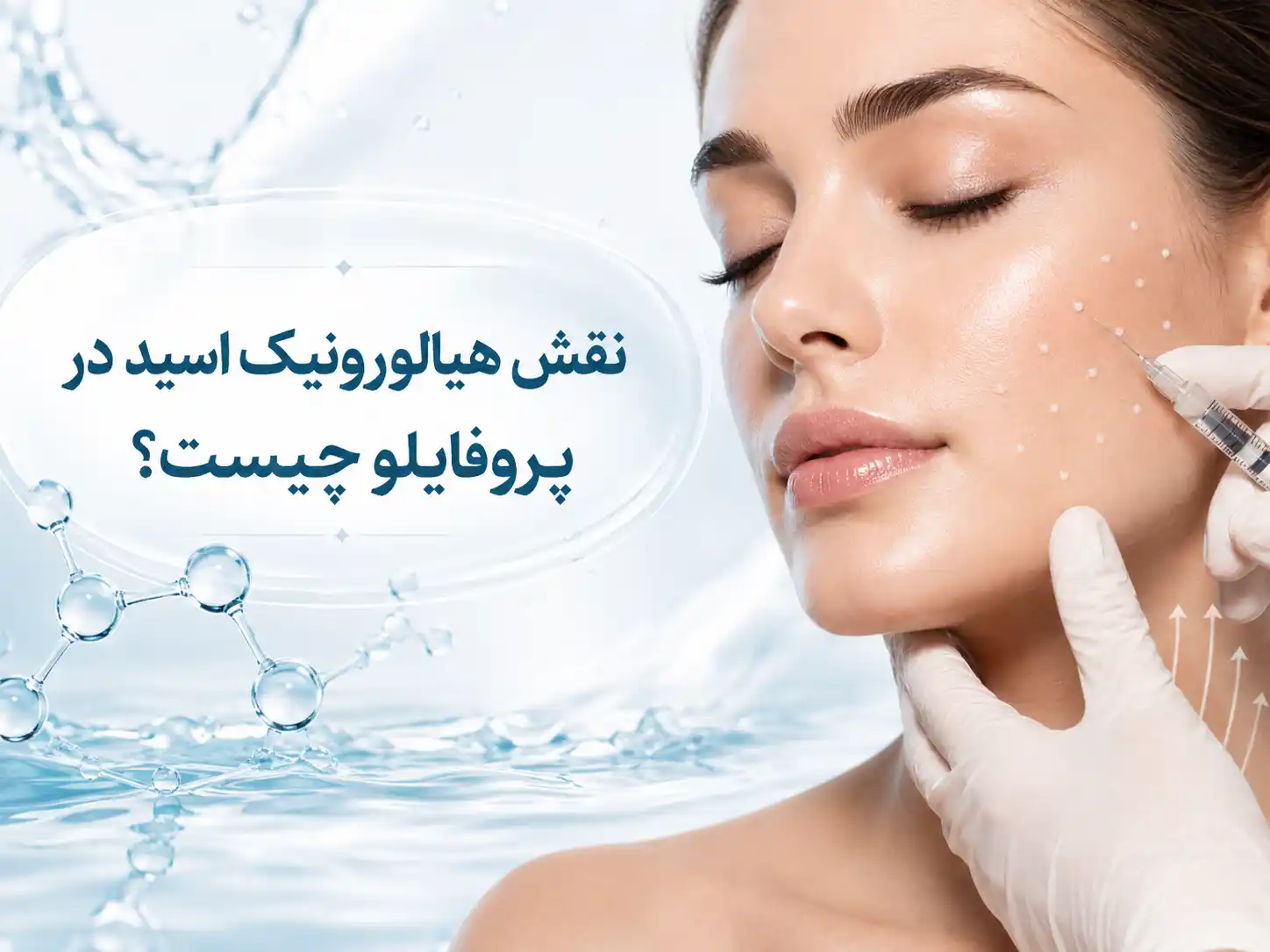 نقش هیالورونیک اسید در پروفایلو چیست؟