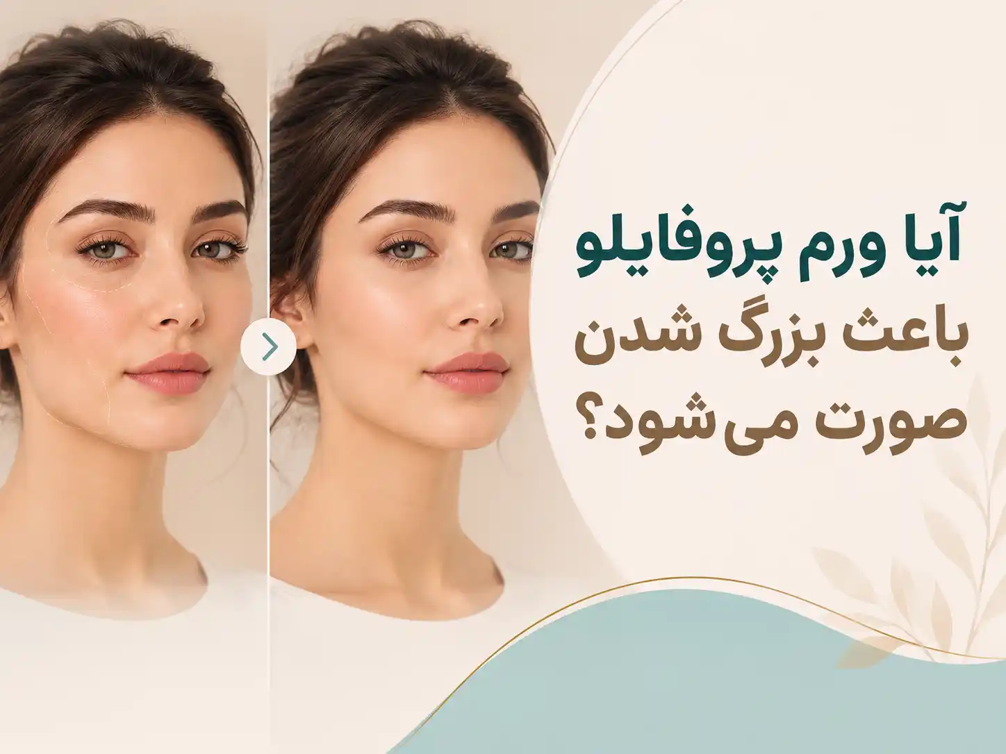 آیا ورم پروفایلو باعث بزرگ شدن صورت می‌شود؟