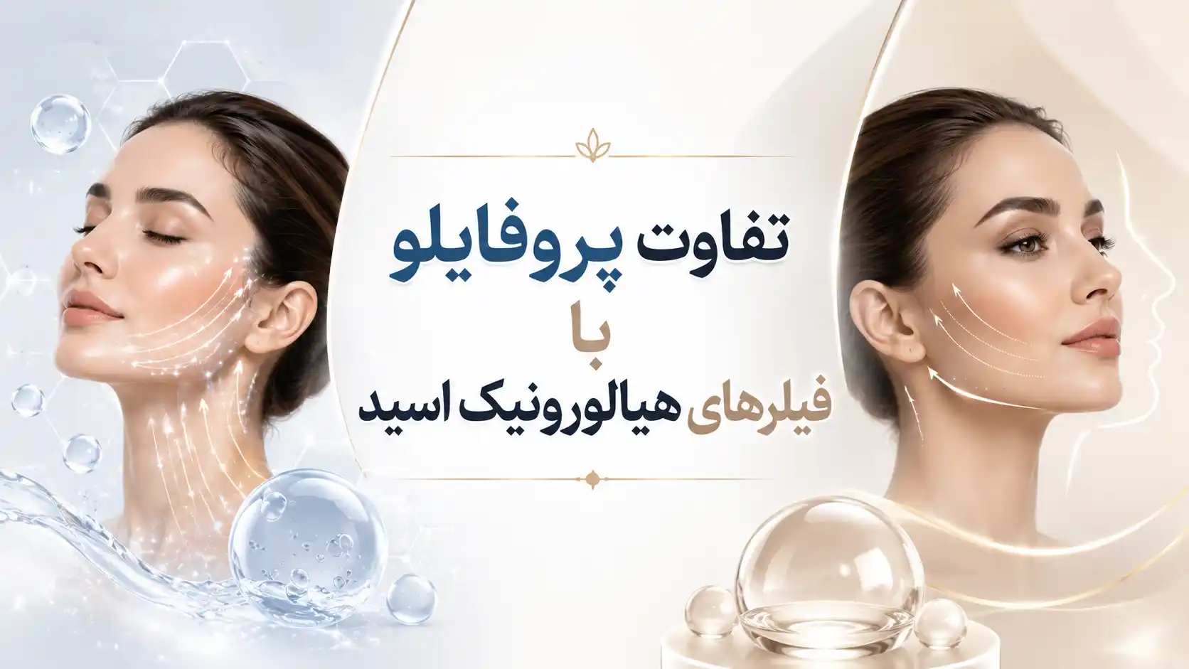 تفاوت پروفایلو با فیلرهای هیالورونیک اسید