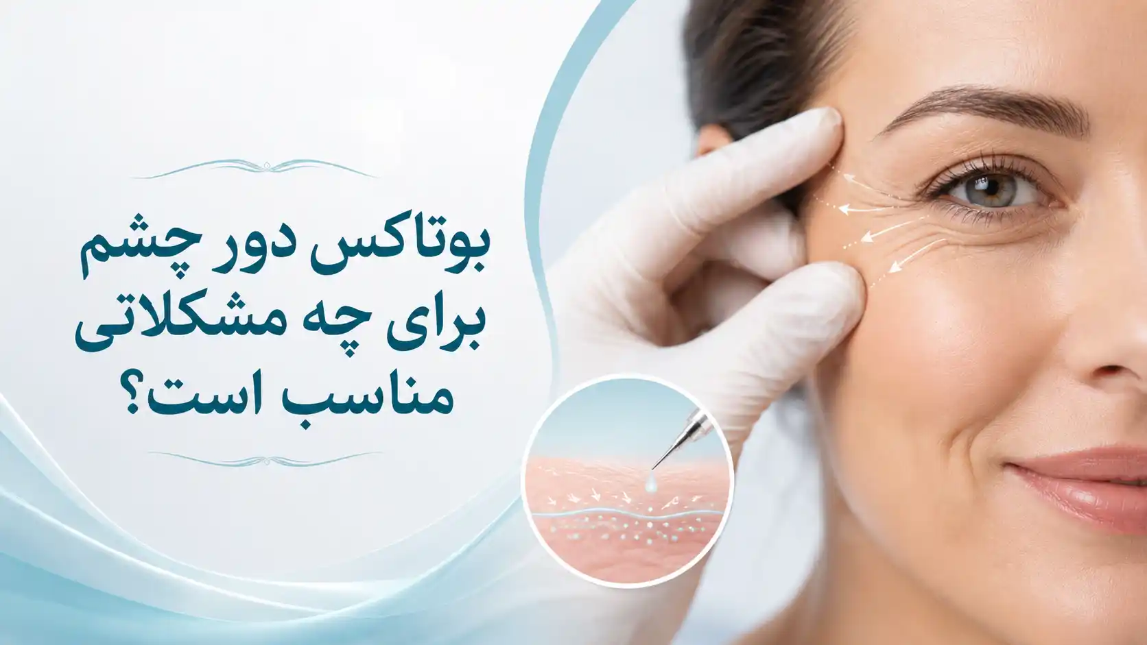 بوتاکس دور چشم برای چه مشکلاتی مناسب است؟