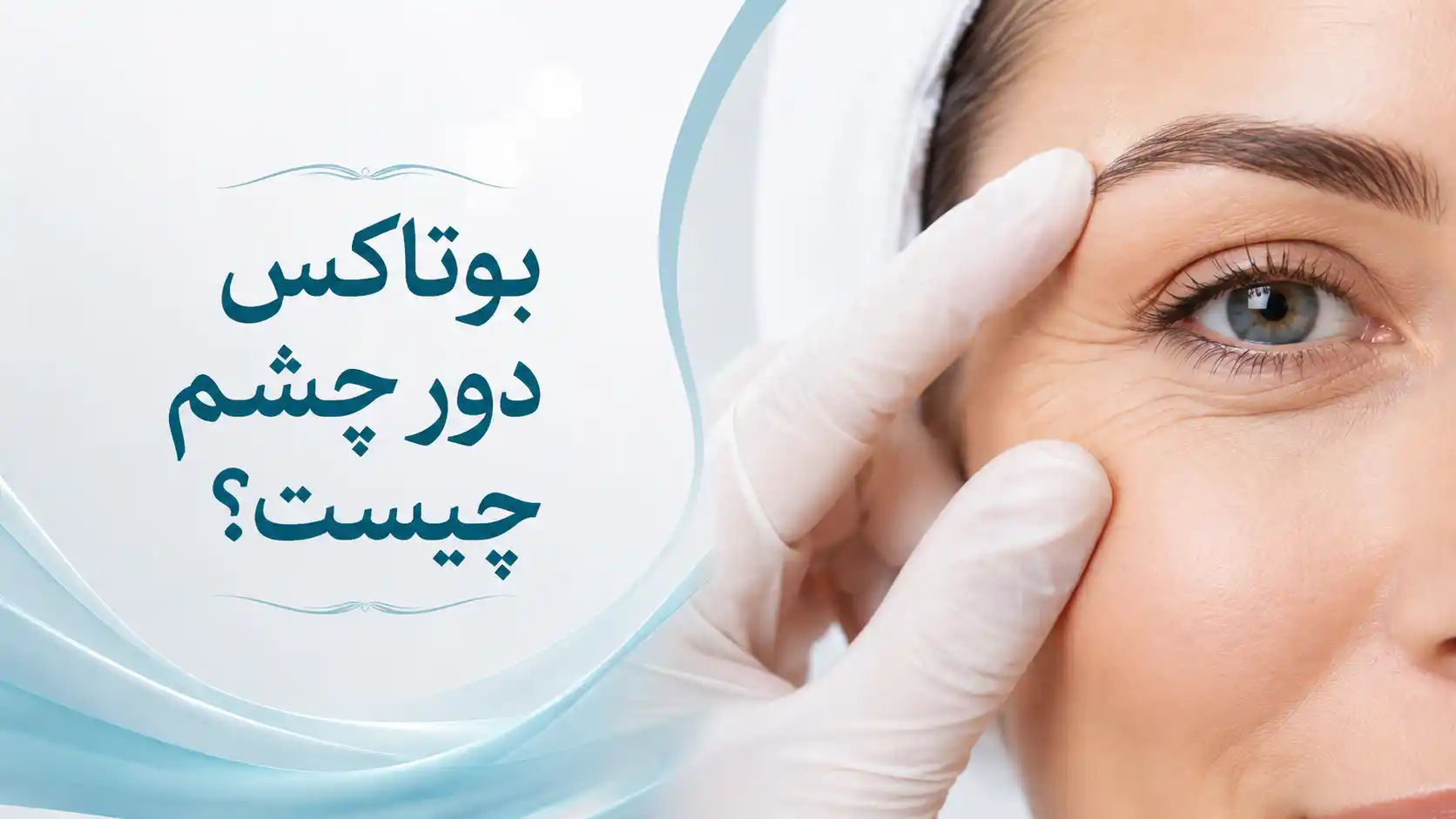 بوتاکس دور چشم چیست؟