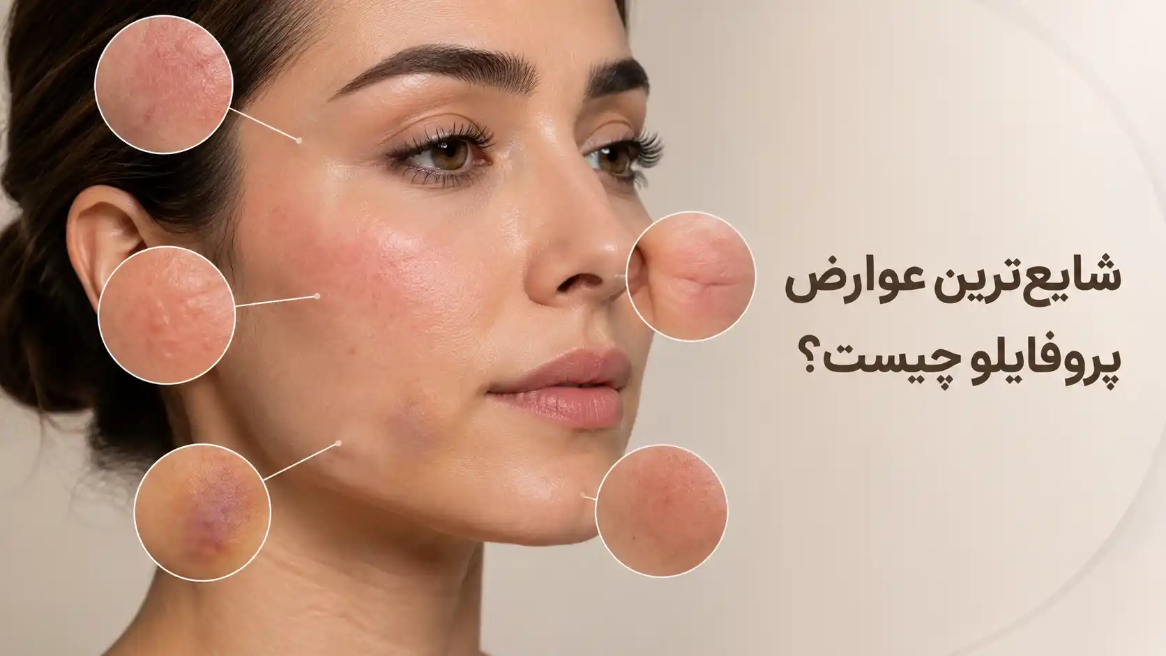 شایع‌ترین عوارض پروفایلو چیست؟