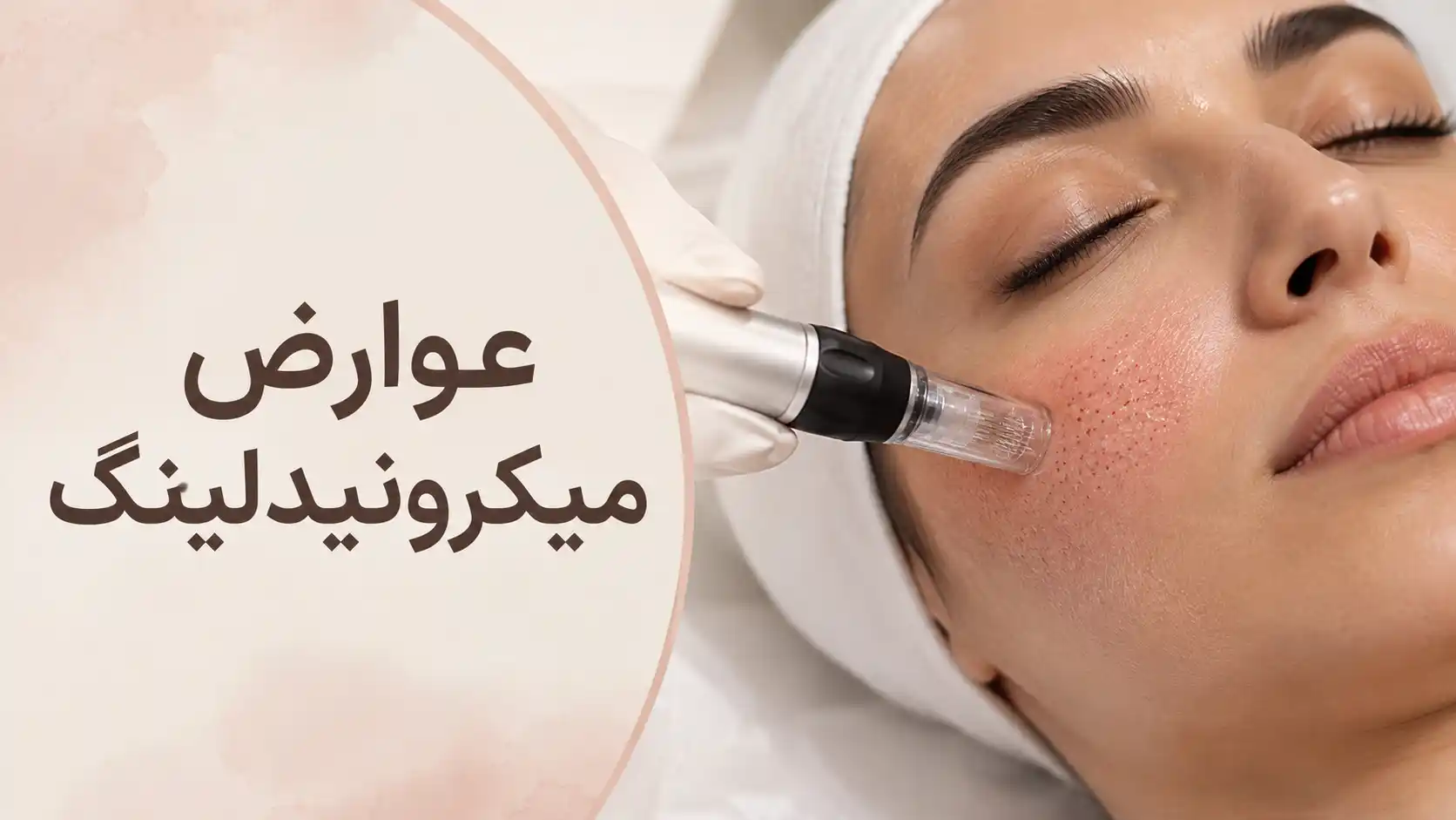 عوارض میکرونیدلینگ