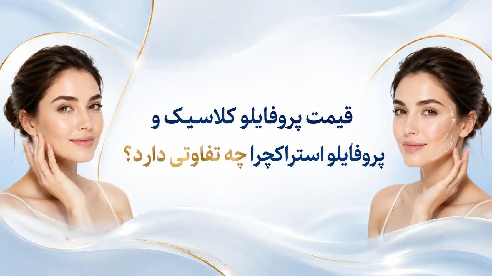 قیمت پروفایلو کلاسیک و پروفایلو استراکچرا چه تفاوتی دارد؟