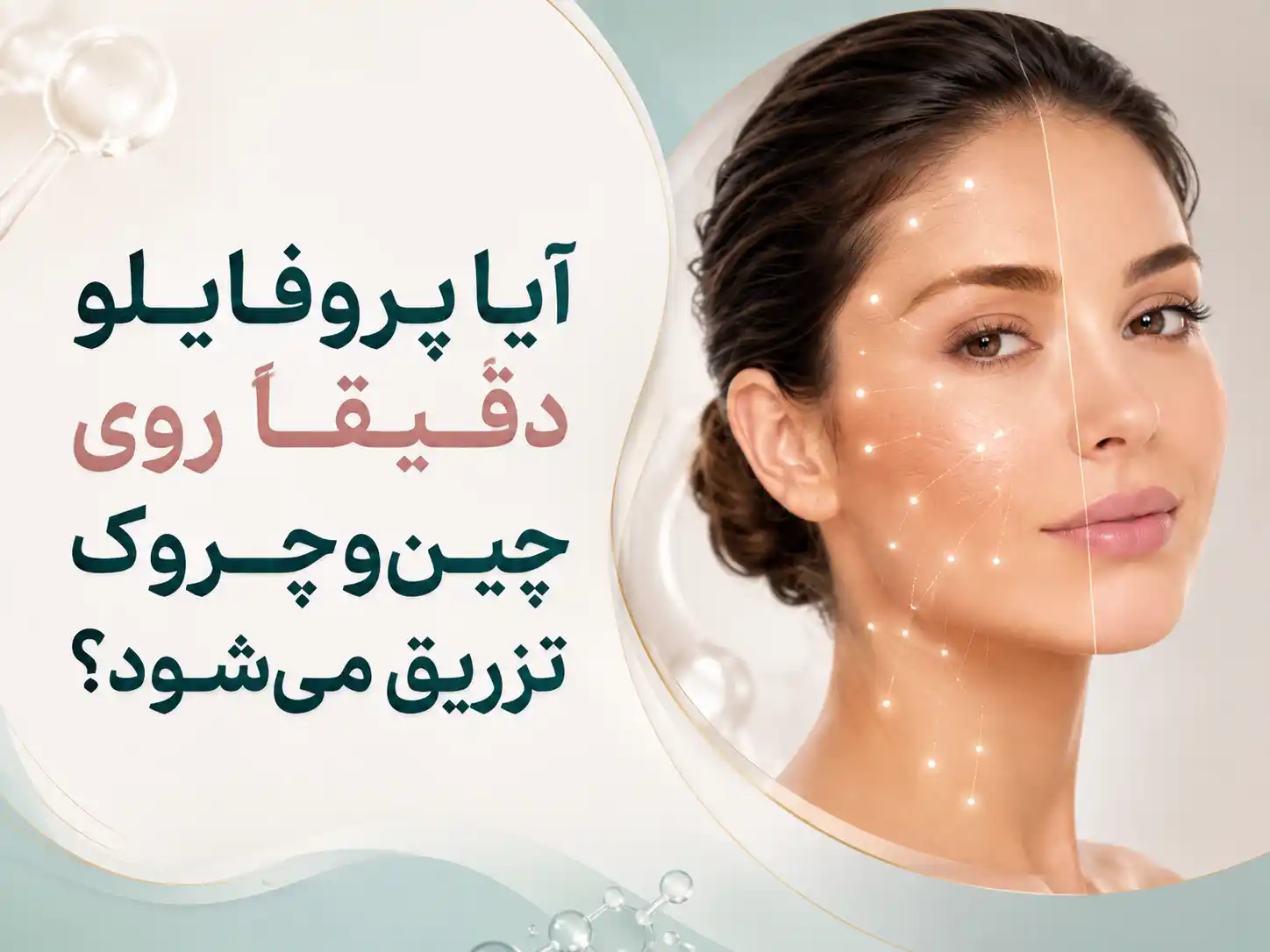 آیا پروفایلو دقیقاً روی چین‌وچروک تزریق می‌شود؟