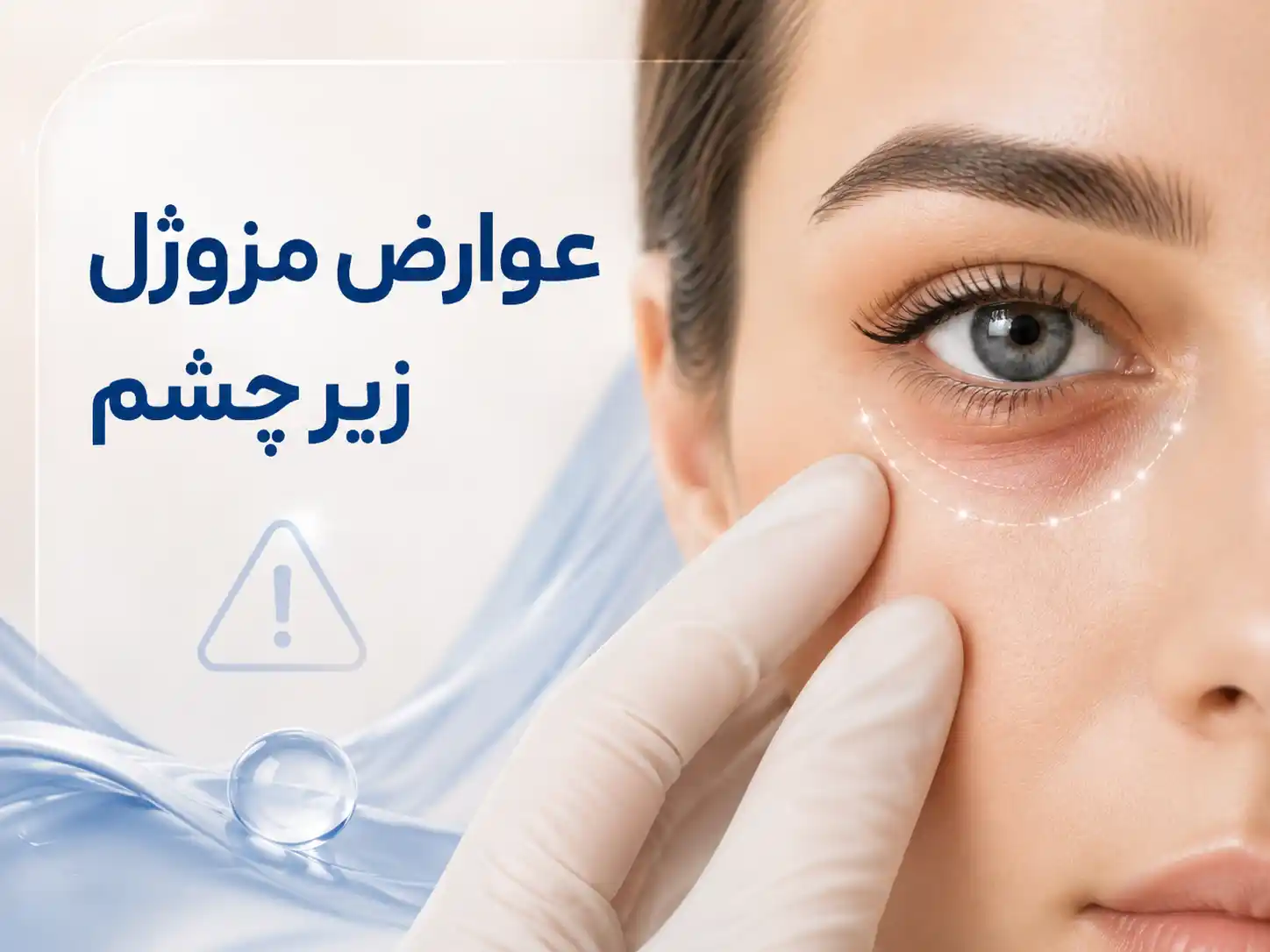 عوارض مزوژل زیر چشم