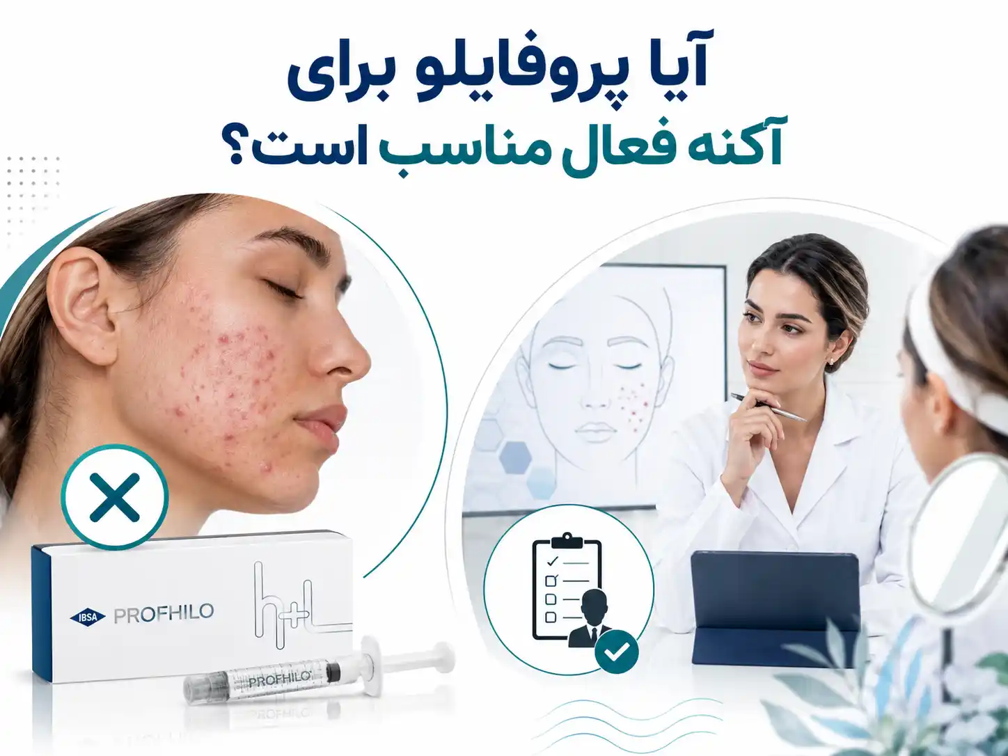 آیا پروفایلو برای آکنه فعال مناسب است؟