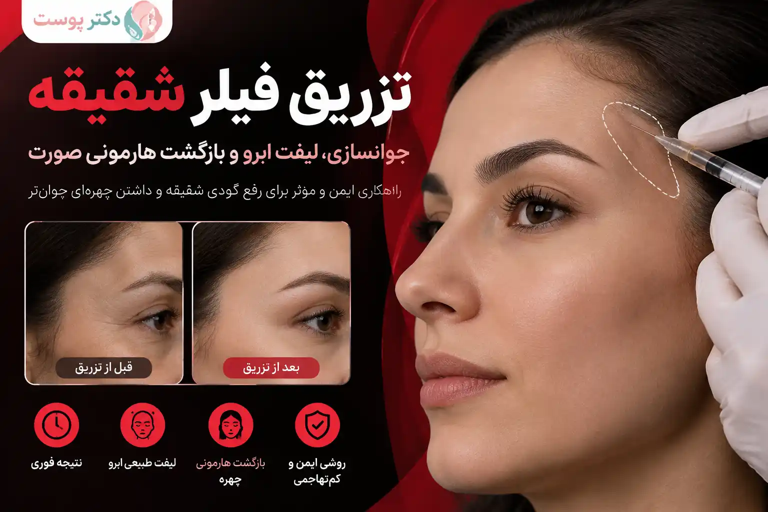 تزریق فیلر شقیقه؛ راهنمای جامع کانتورینگ گیجگاه، نقاط خطر و مقایسه با لیفت
