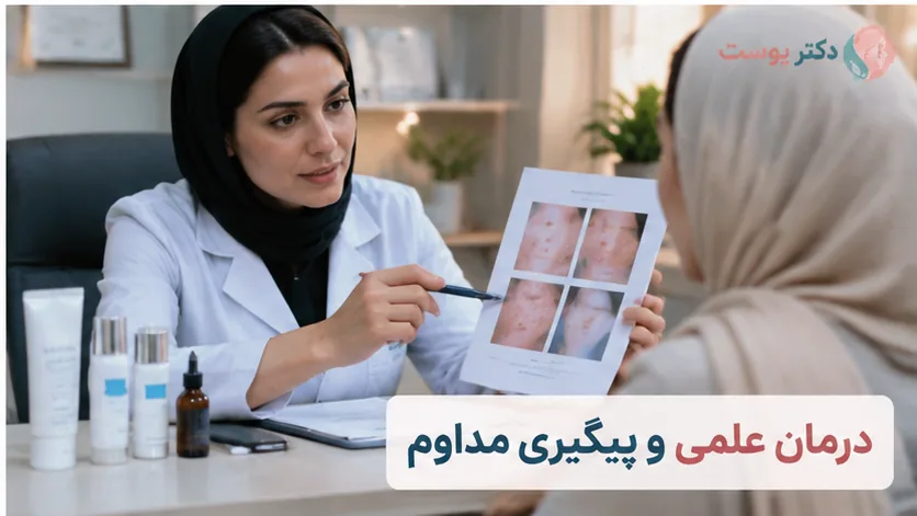 درمان لک ملاسما صورت